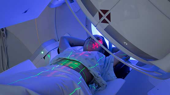 Radiotherapy scan of women